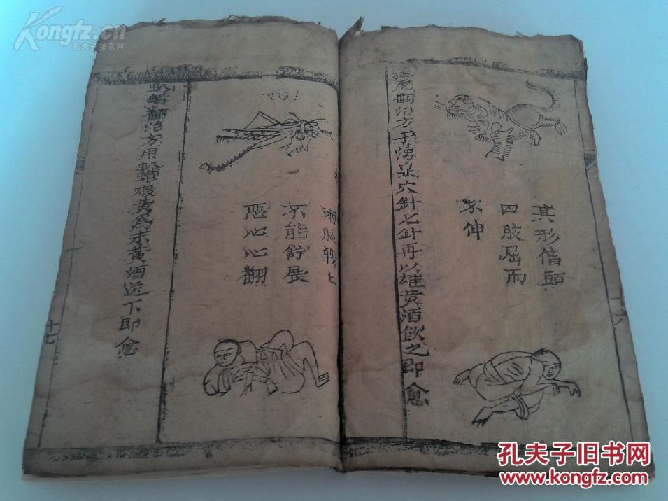 俗称《七十二翻症》,内收一百四十余幅病症版画图,此书记载了七十二种