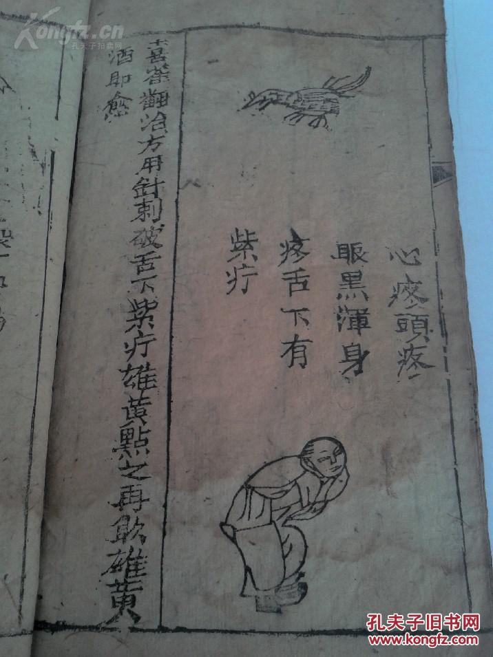 俗称《七十二翻症》,内收一百四十余幅病症版画图,此书记载了七十二种