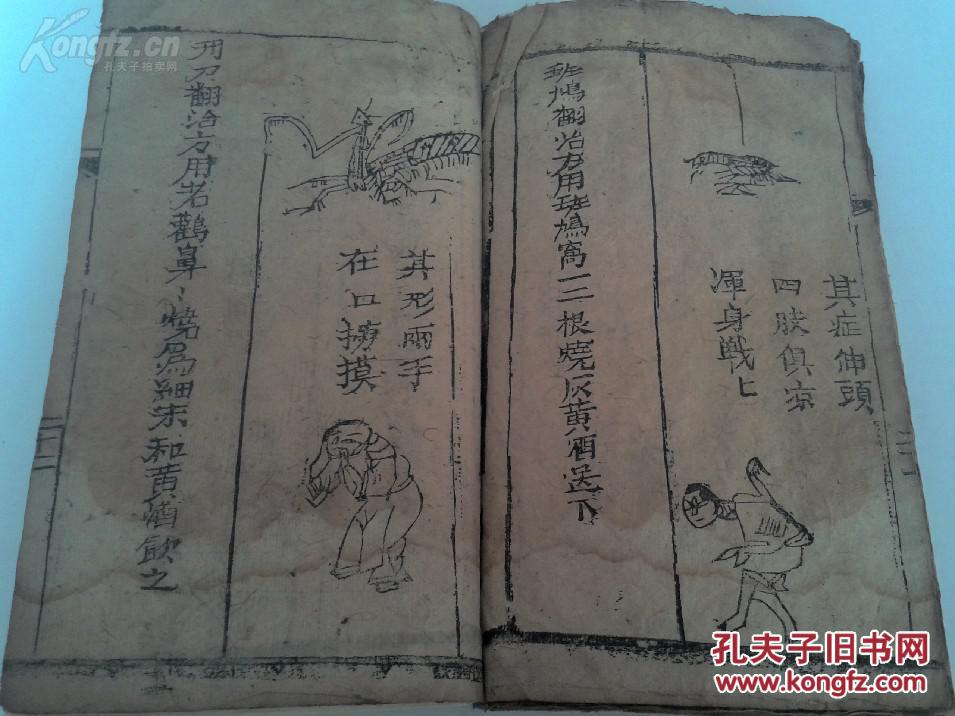 俗称《七十二翻症》,内收一百四十余幅病症版画图,此书记载了七十二种