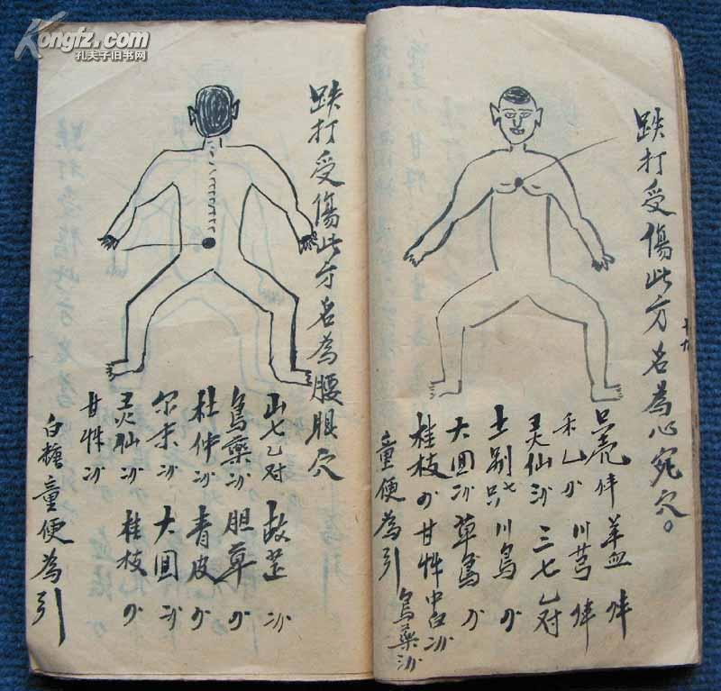 带40余幅绘图,有"五百钱"手法之玄妙,配有秘传穴伤断根,还魂药方的清