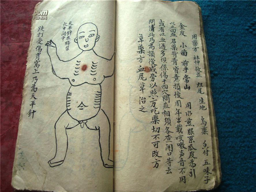 清中期武术点穴跌打损伤精写绘本图文并茂