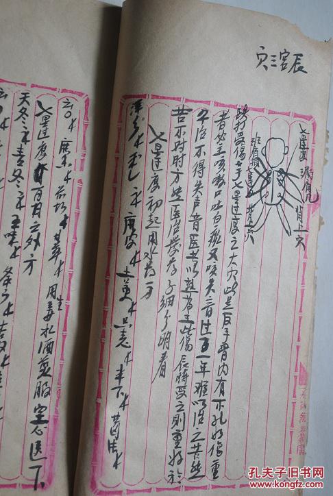 手抄本,中医药治疑难杂病,跌扑损伤,穴位伤药剂秘方【子宫三穴,辰宫三