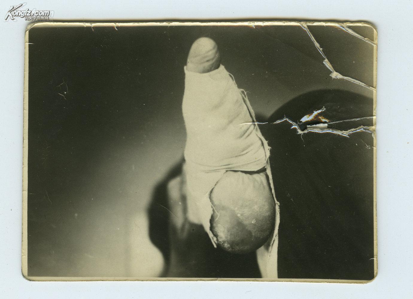 民国妇女小脚缠足三寸金莲特写照片