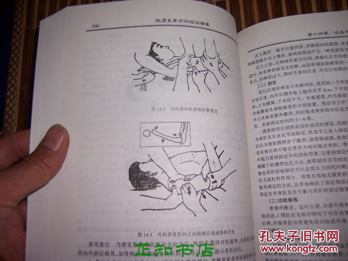 陈渭良骨伤科临证精要