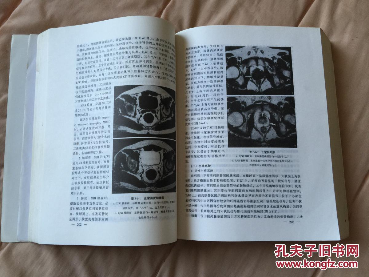 供医学影像学专业用医学影像诊断学吴恩惠主编私藏书内页未阅全新