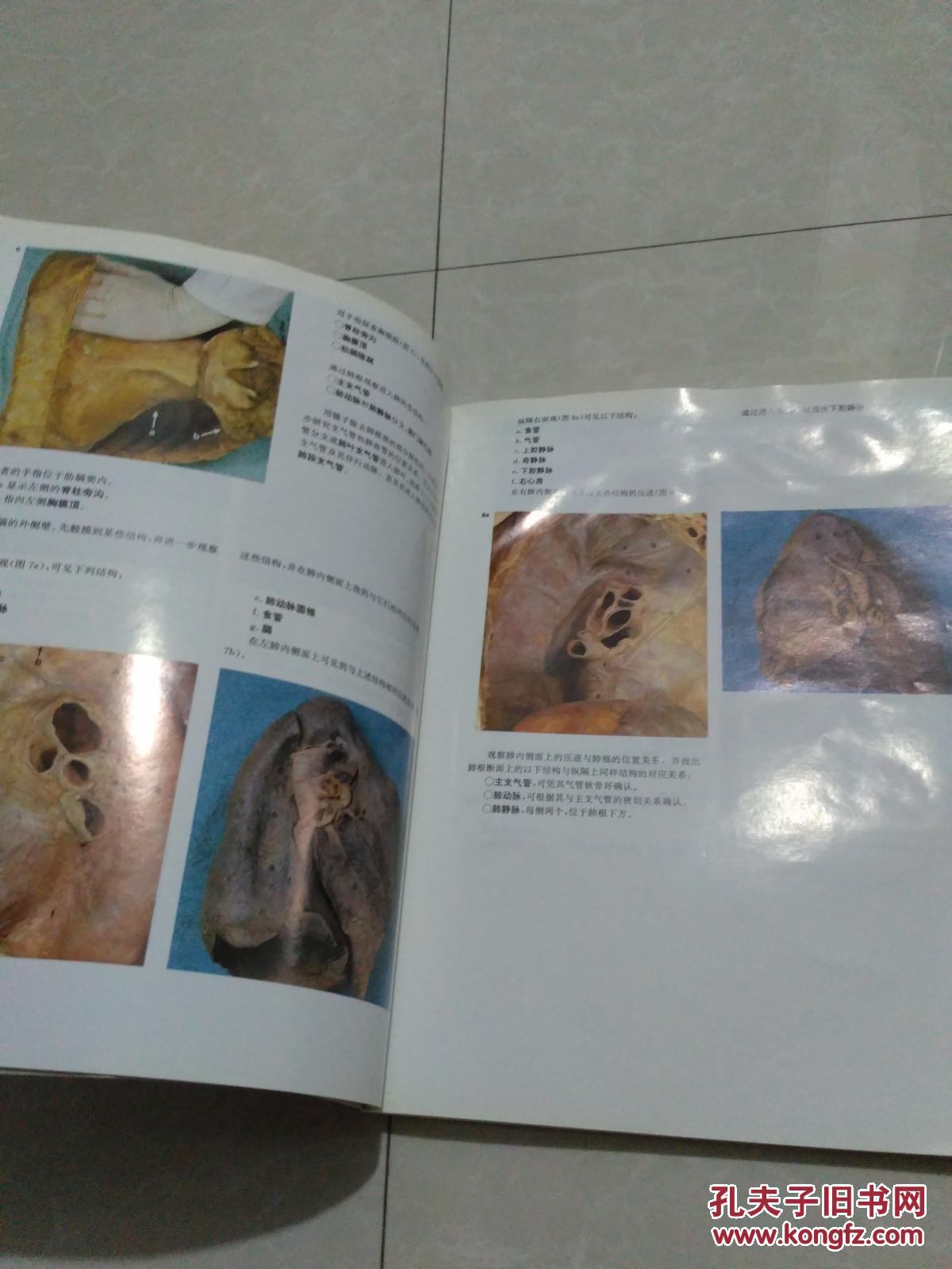 人体实地解剖彩色图谱:第二版