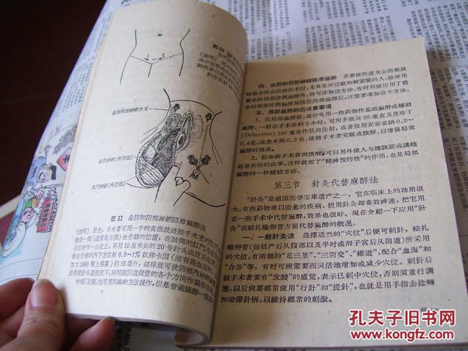 输卵管结扎手术图解(1959年版)