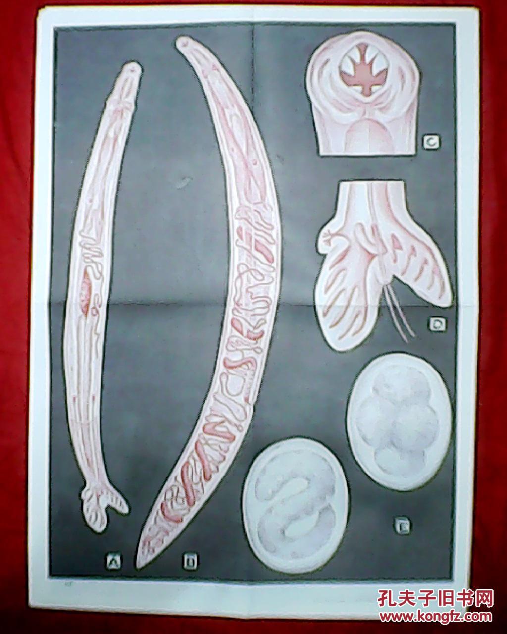 老画家金丽贞绘的教学挂图:钩虫(此为对开挂图,宽53厘米,高77厘米;含6