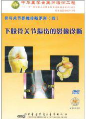 骨与关节影像诊断系列（四）——下肢骨关节损伤的影像诊断