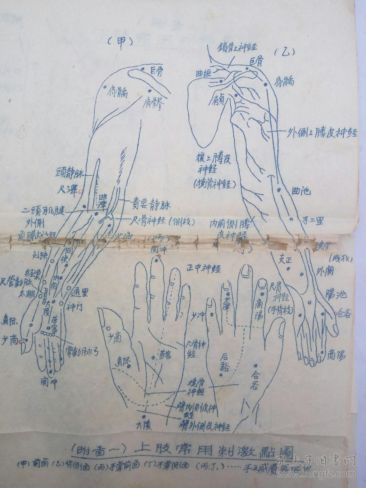 针灸图文普及读本(解放后油印竖版繁体右翻,书名是卖方暂定的.