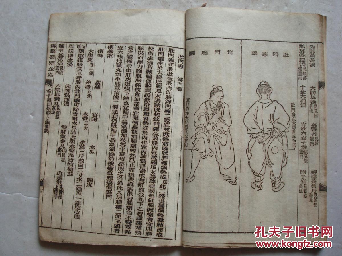 民国御篡医宗金鉴卷十一本编辑外科心法要诀股阴疽图青腿牙疽等有图