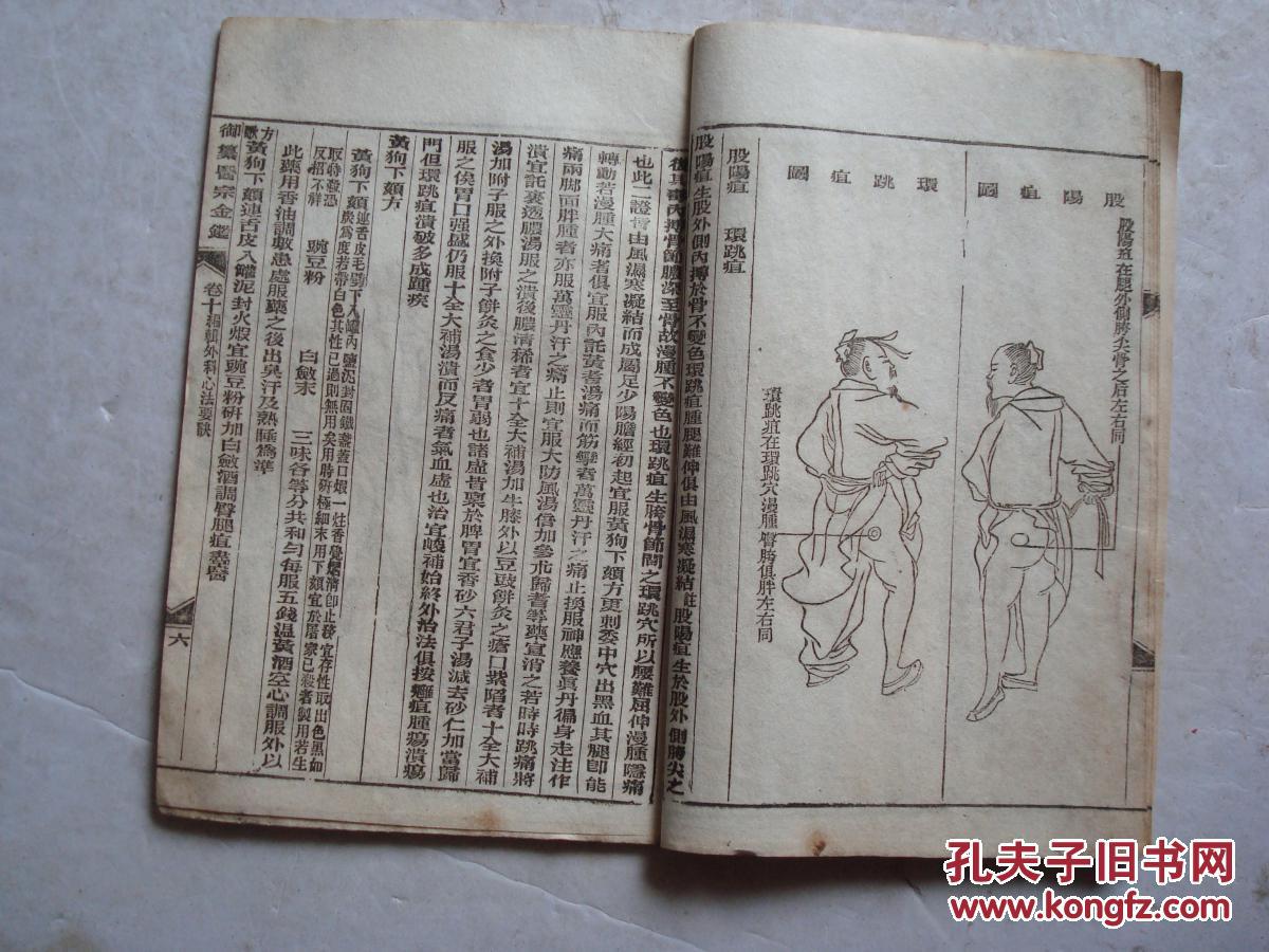 民国御篡医宗金鉴卷十一本编辑外科心法要诀股阴疽图青腿牙疽等有图