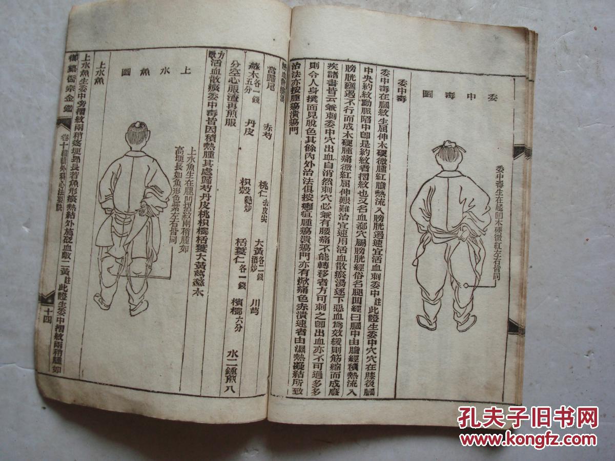 民国御篡医宗金鉴卷十一本编辑外科心法要诀股阴疽图青腿牙疽等有图
