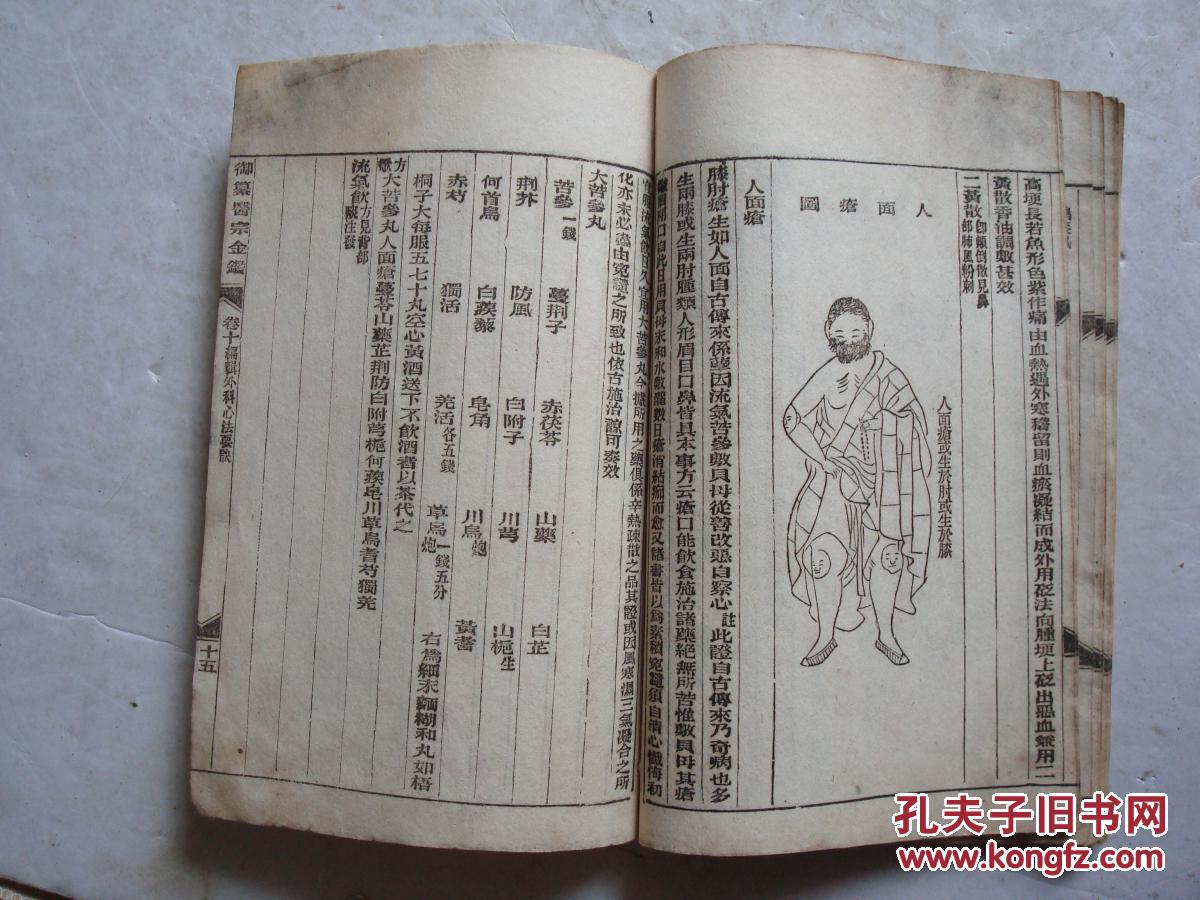 民国御篡医宗金鉴卷十一本编辑外科心法要诀股阴疽图青腿牙疽等有图