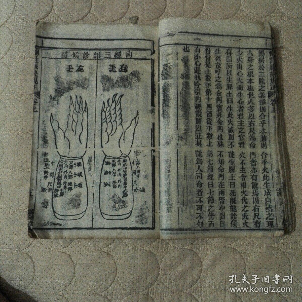 脉诀规正全部沈微垣先生删注康熙三十有二年癸酉元日瀛津薇垣沈镜自亭