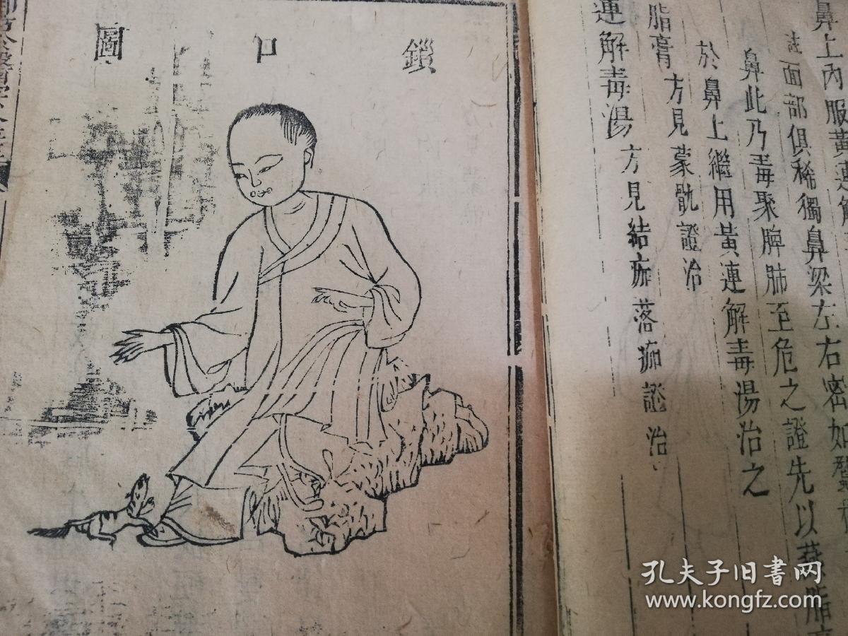 xs5425清代中医书御慕医宗金鉴木刻大开版本存4册