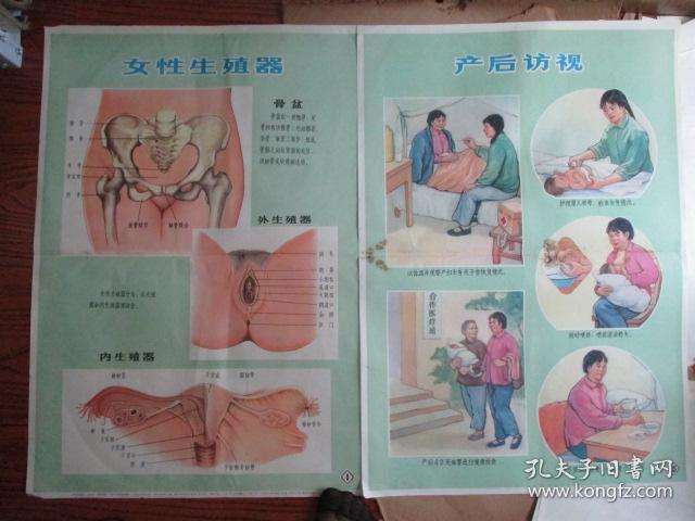 早期宣传画新法接生挂图供赤脚生用女性生殖器产后访视2张合售