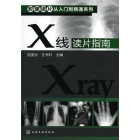 影像读片从入门到精通系列：X线读片指南