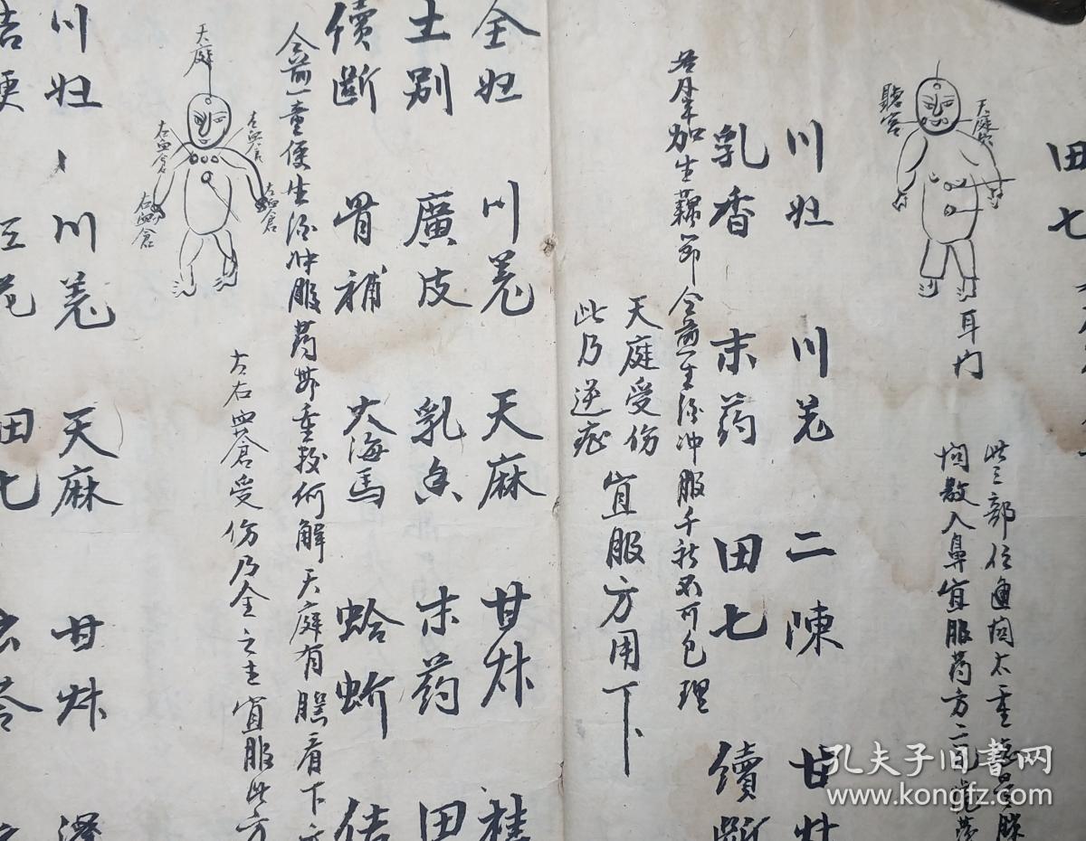 中医古籍手抄本5前半部分是各种穴位伤附图标注以及