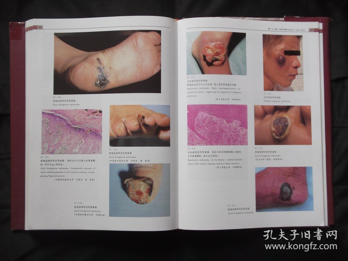 皮肤病及性病彩色图谱