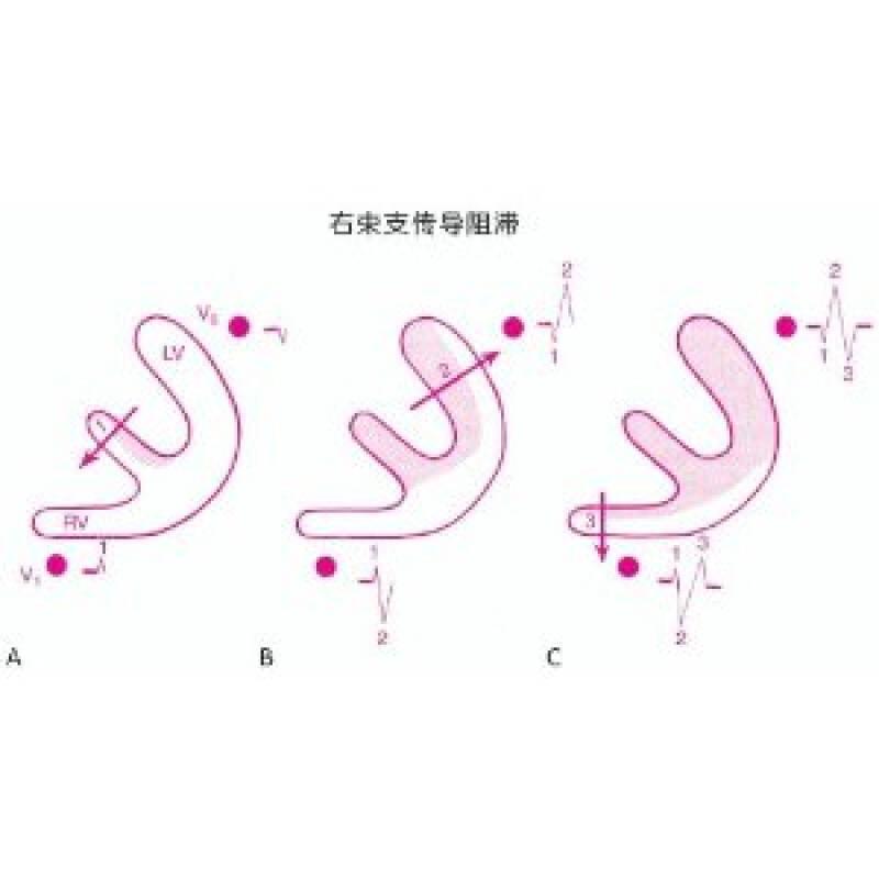 临床心电图快速入门（第八版）