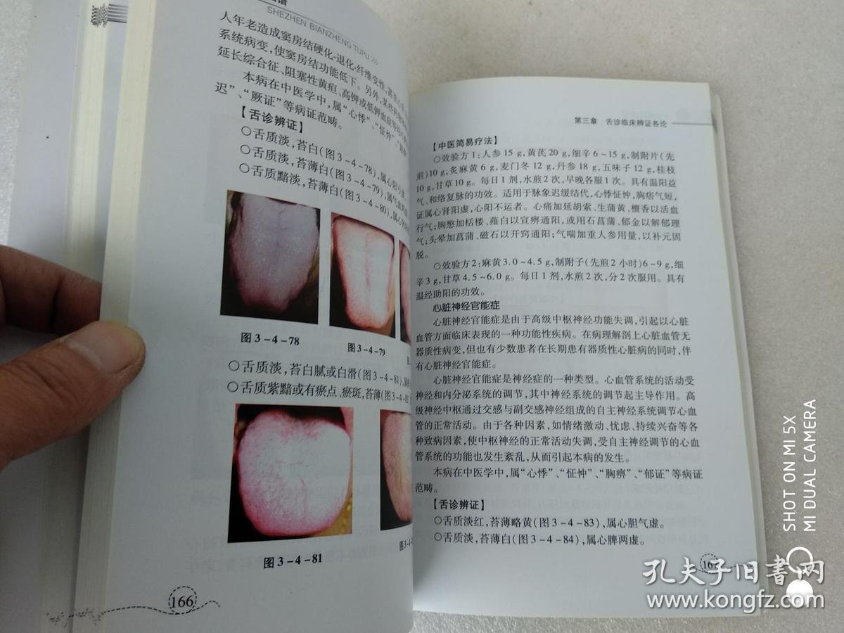 舌诊辩证图谱(2010年一版一印)