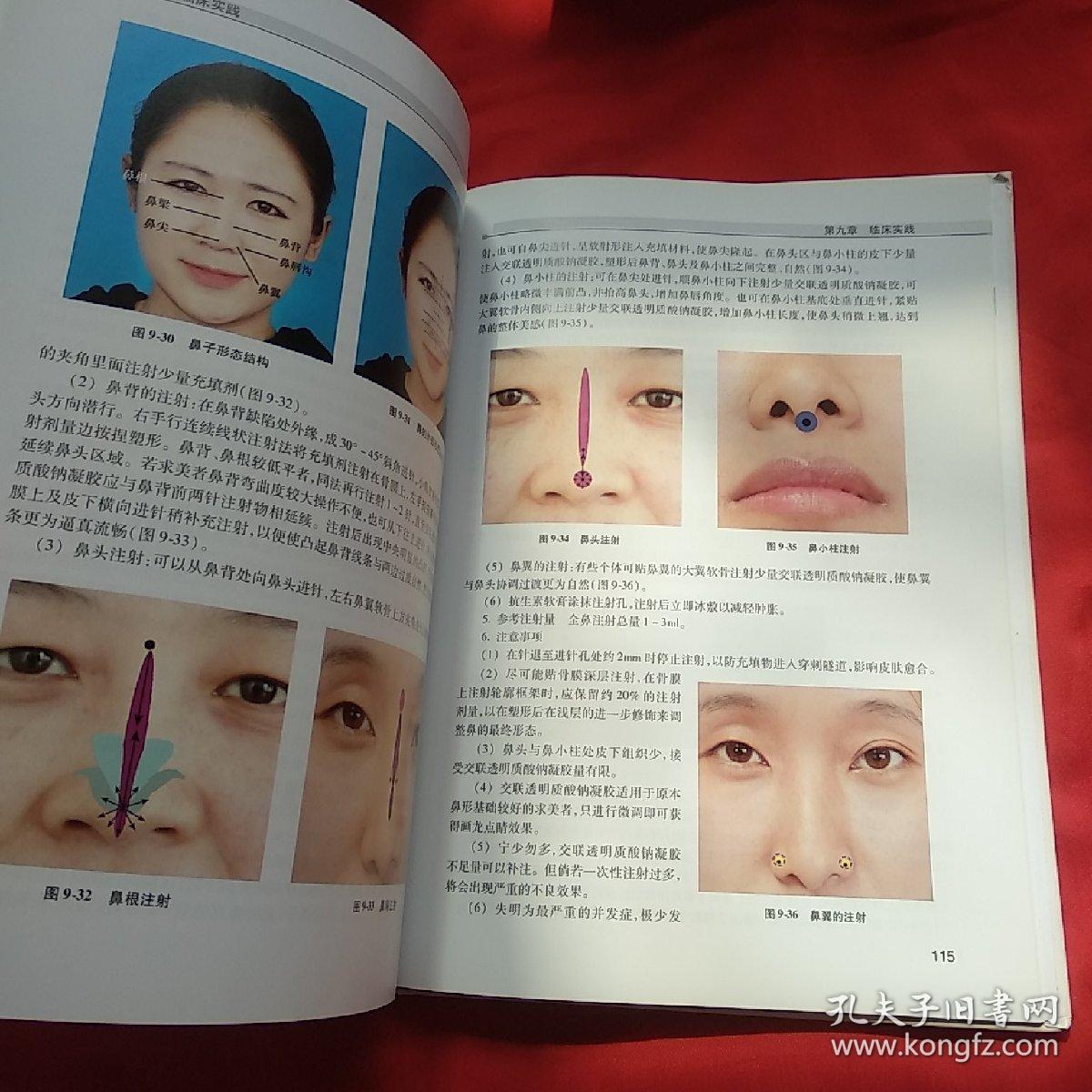 交联透明质酸钠凝胶微整形理论与实践_蒙一纯 著,宋慧锋 著_孔夫子