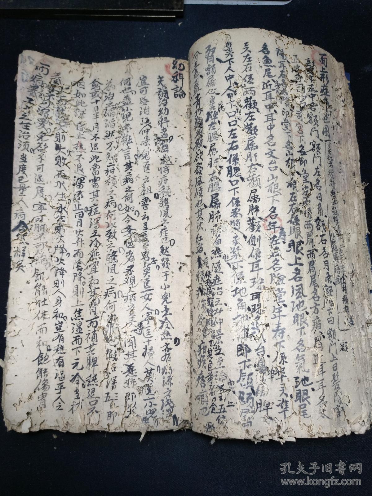 中医疮科手抄十六开大本厚册先洗后敷治恶疮毒疮蛇疮连珠疮粪门廯牛皮