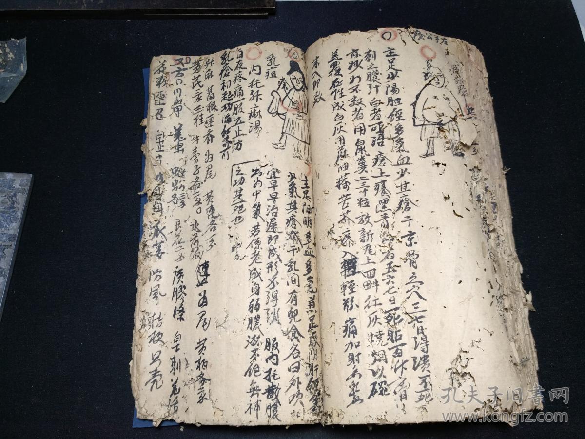 中医疮科手抄十六开大本厚册先洗后敷治恶疮毒疮蛇疮连珠疮粪门廯牛皮
