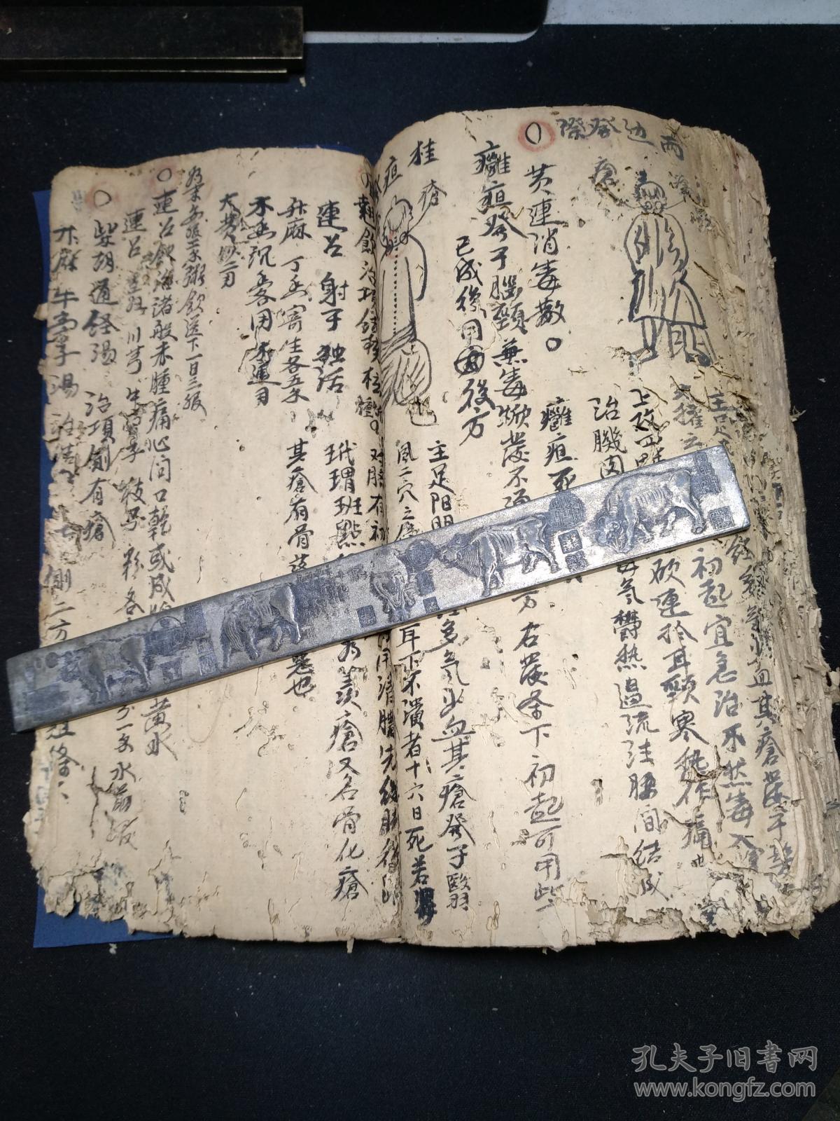 中医疮科手抄十六开大本厚册先洗后敷治恶疮毒疮蛇疮连珠疮粪门廯牛皮