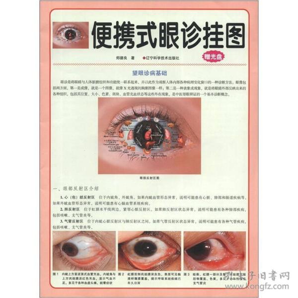 便携式眼诊挂图