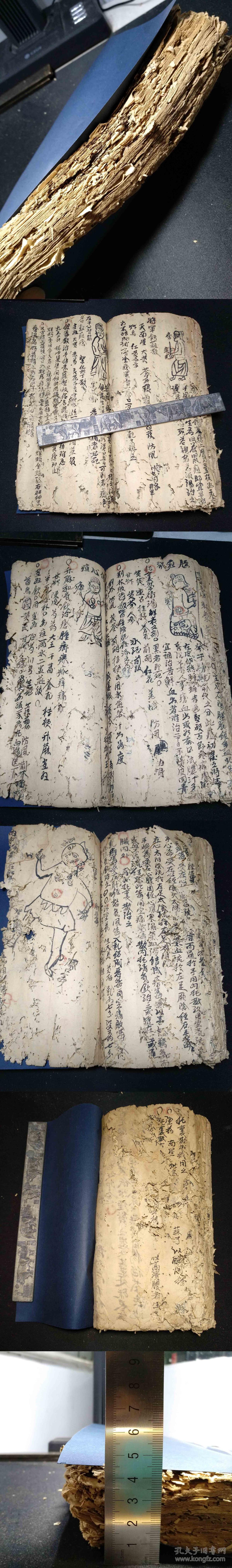 中医疮科手抄十六开大本厚册先洗后敷治恶疮毒疮蛇疮连珠疮粪门廯牛皮