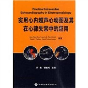 实用心内超声心动图及其在心律失常中的应用