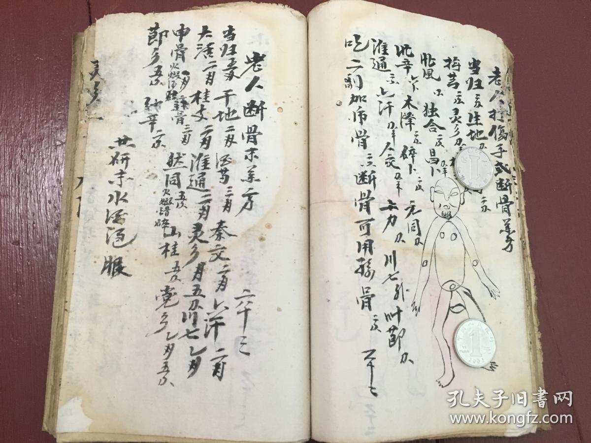 1,跌打抄本,各种跌打伤科的治法及药方,接骨,打死夺命丹,腿脚受伤