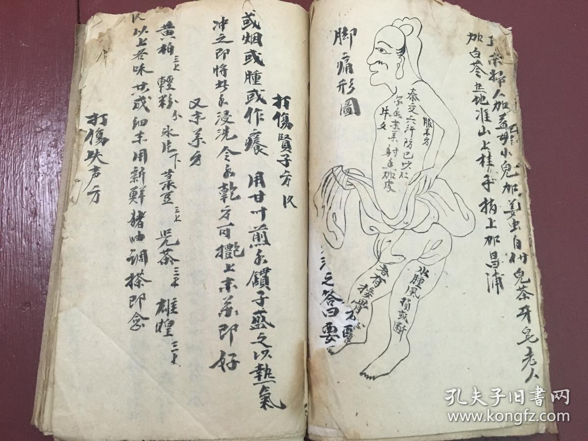 1,跌打抄本,各种跌打伤科的治法及药方,接骨,打死夺命丹,腿脚受伤