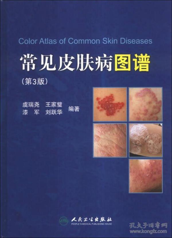 1127条结果|皮肤病图谱