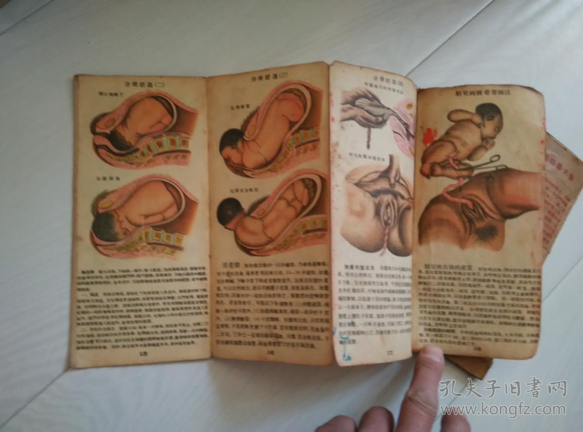 早期人体解剖图生育图鉴2册合售
