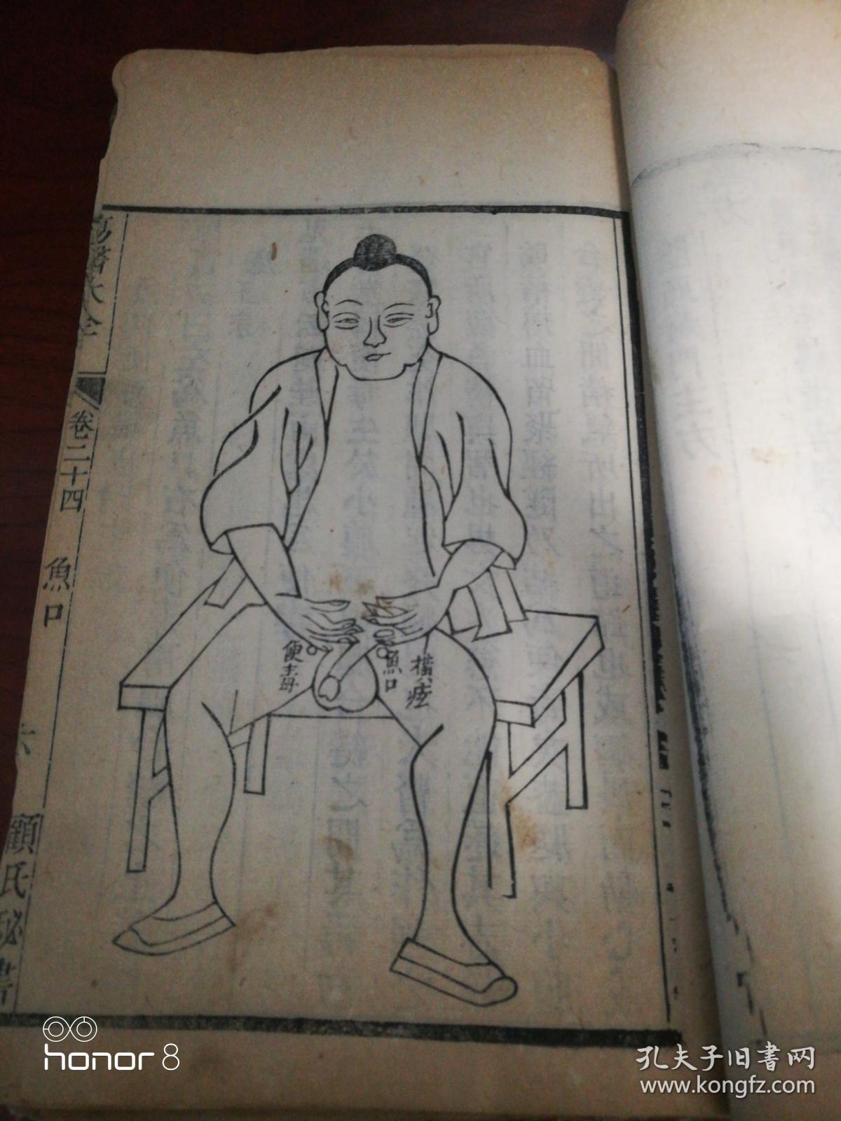 痈横痃鱼口便毒图片阴疮旧社会女性鱼口病鱼口病鱼口性病鱼口便毒疡医