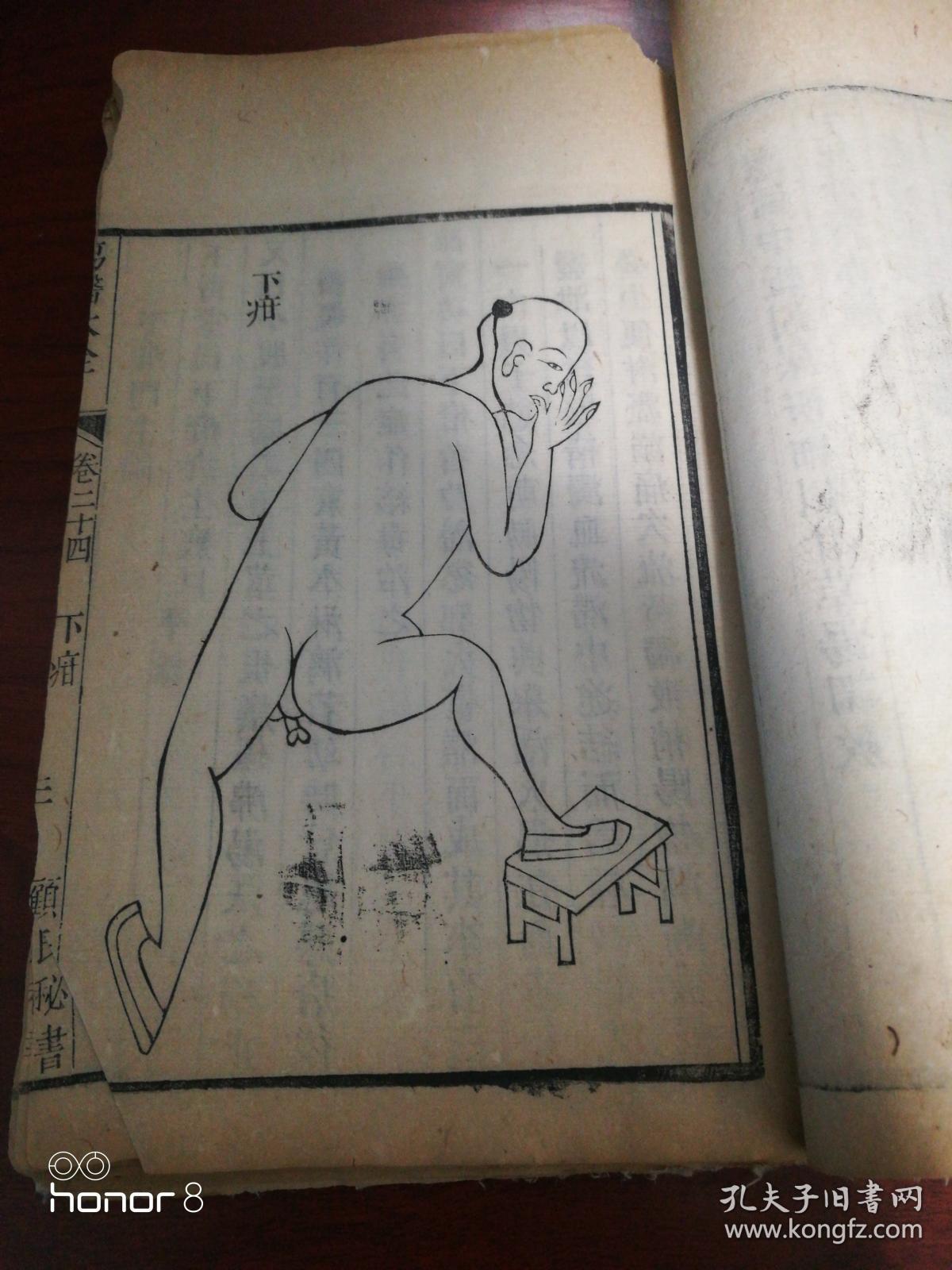 《疡医大全》卷二十四前阴部(龟头肿痛门,阴头痈门,鱼口便毒横痃门,阴