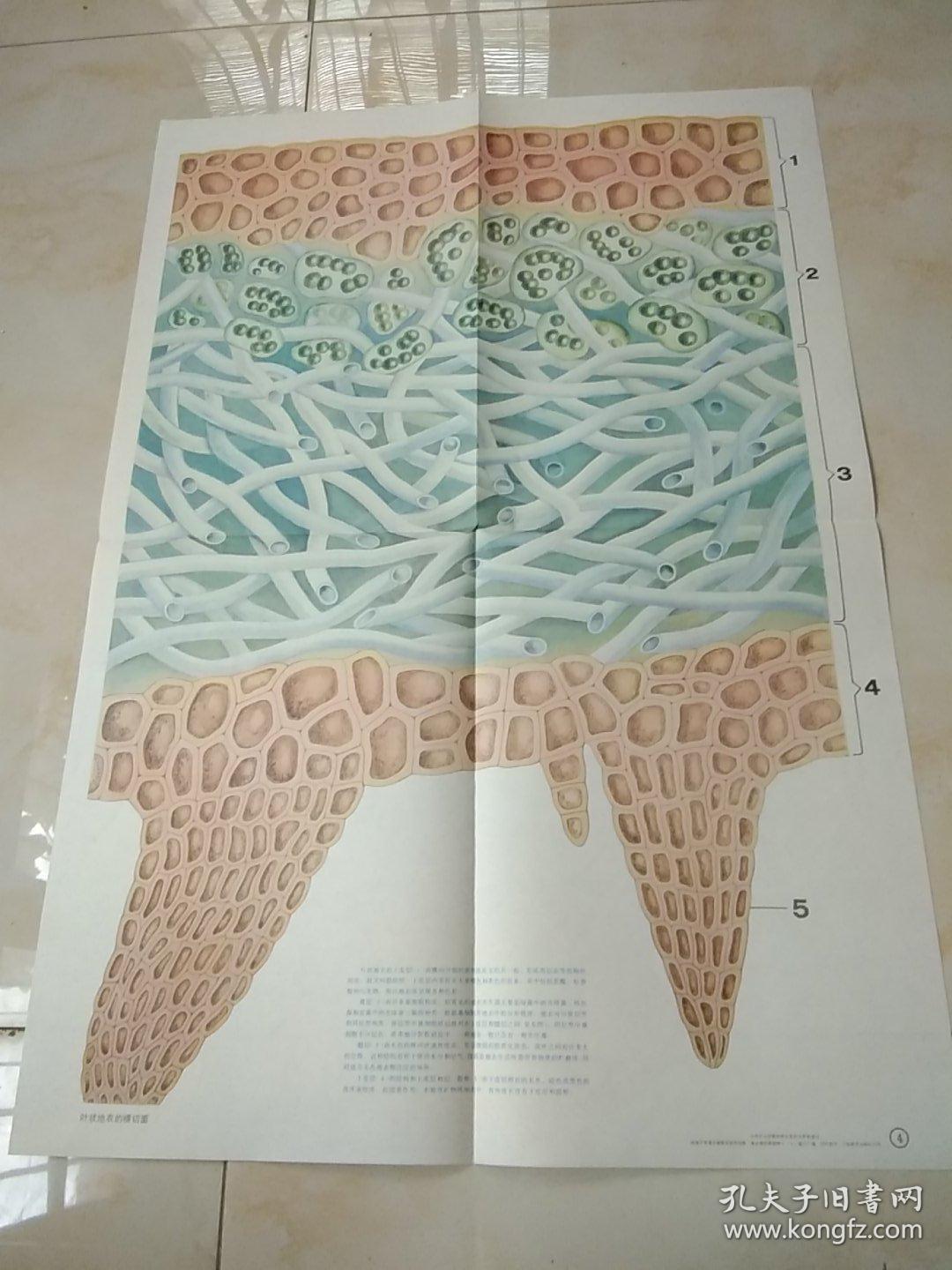 挂图 叶状地衣的横切面.