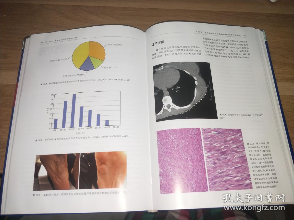 软组织肉瘤诊疗科(主译 陆维祺签赠本)