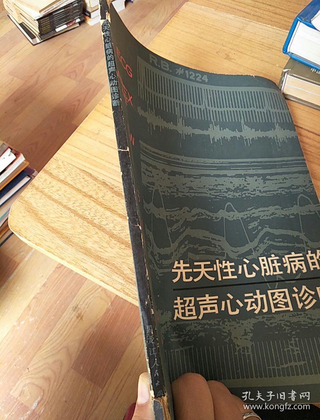 先天性心脏病的超声心动图诊断
