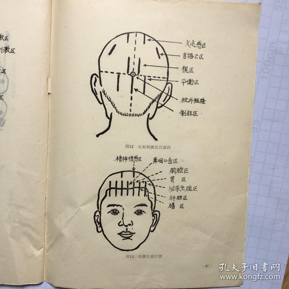 颊针疗法资料汇编