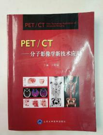 PET/CT：分子影像学新技术应用