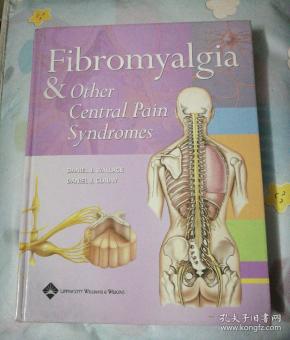fibromyalgia & other central pain syndromes(纤维肌痛和其他中枢性