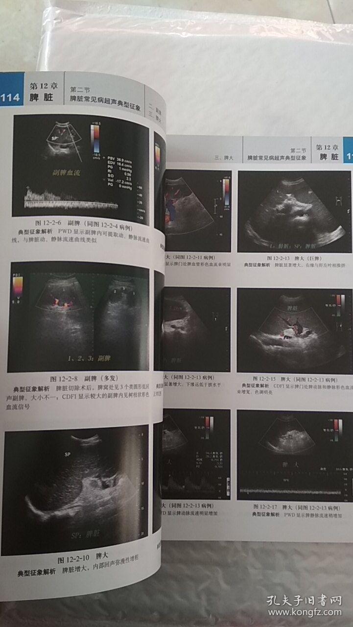超声典型征象实用图典