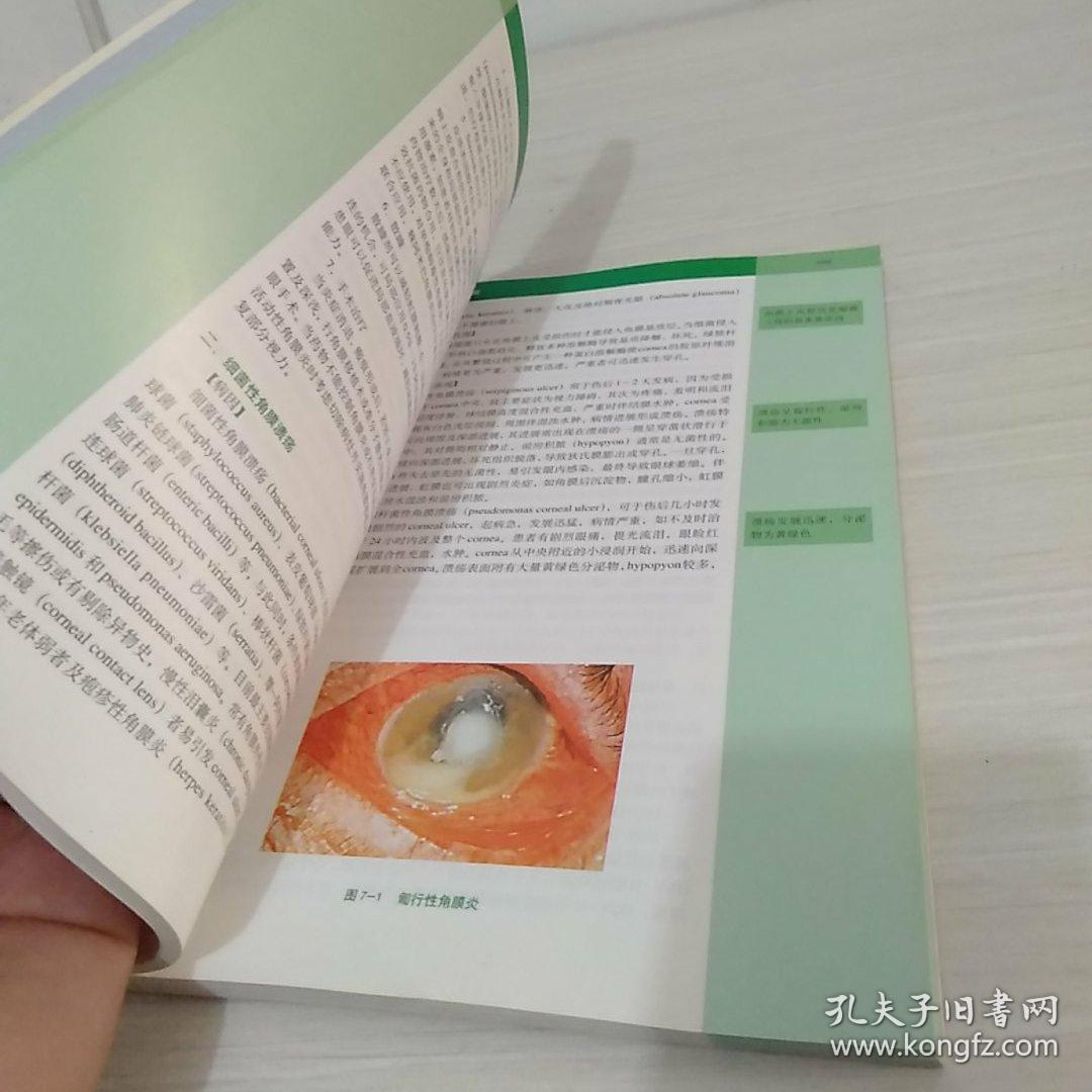 北京大学医学教材:眼科学 正版书