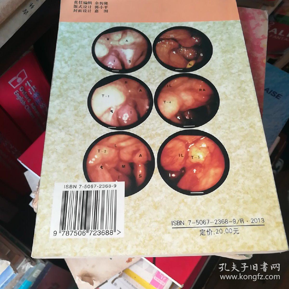 食物进入气管后用什么办法排出【食物进入气管】