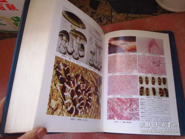 法医病理学 16开精装带护封 1200多页后有近100页照片