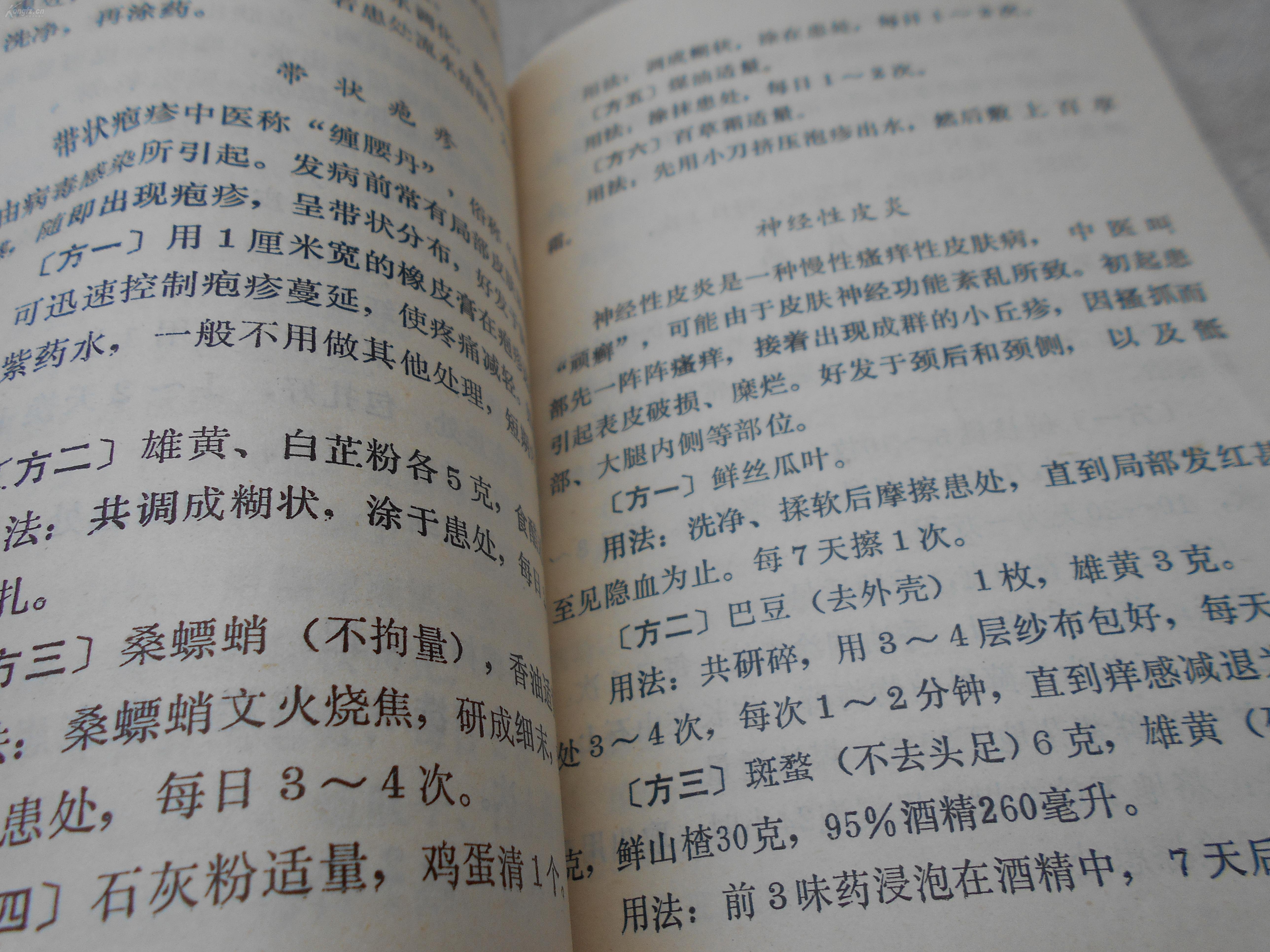 上呼吸感染静脉注射的药物_有一种咳嗽叫感染后咳嗽_儿童上呼吸道感染后咳嗽